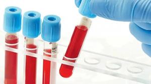 Health Ministry proposes to remove duplicate viral testing of blood products